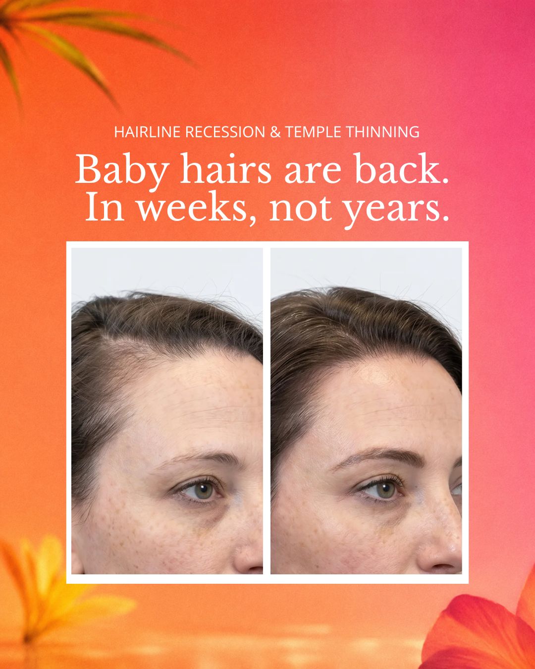 Sérane Korean Revive Hair Serum