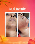 Hair Removal Oil