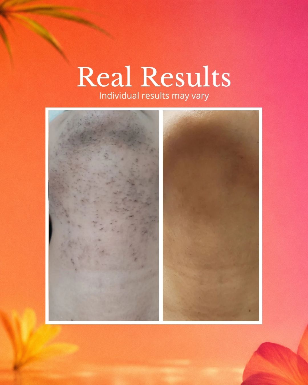 Hair Removal Oil